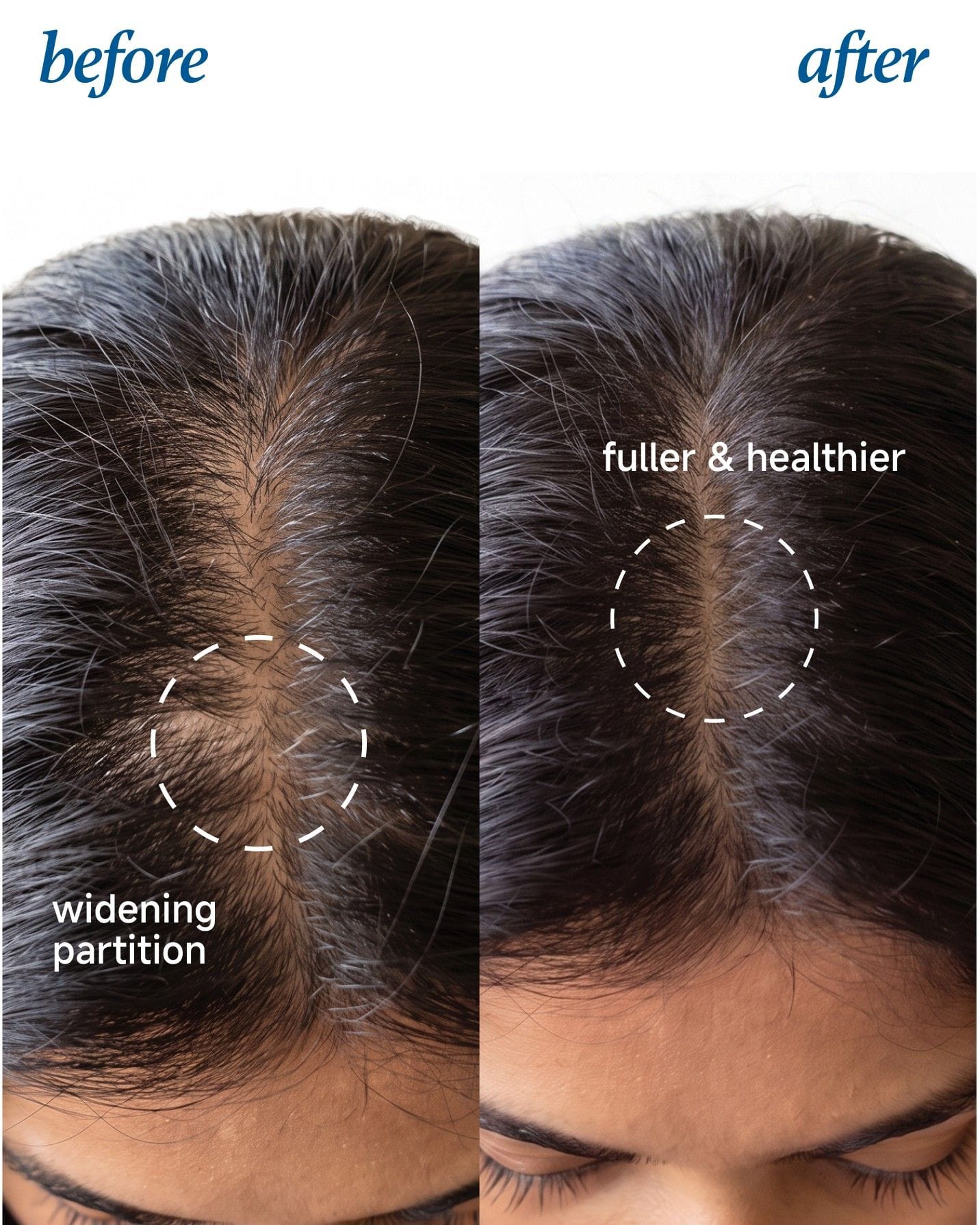 HairVive BodyWise™