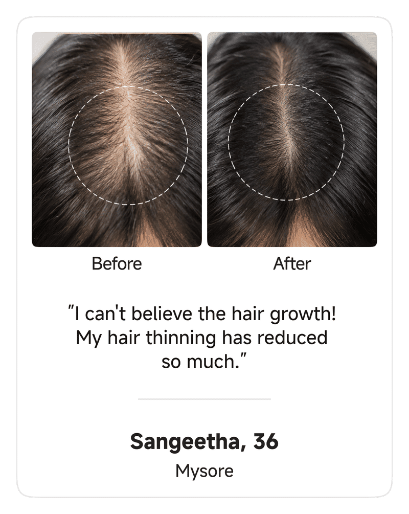 HairVive BodyWise™