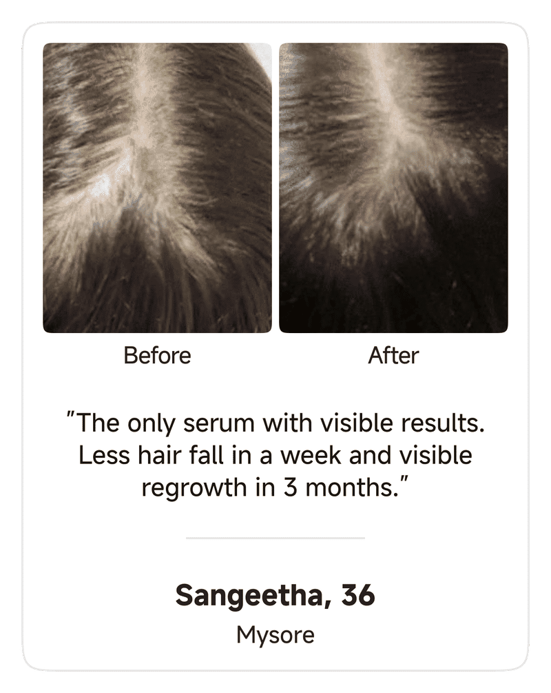 HairVive BodyWise™